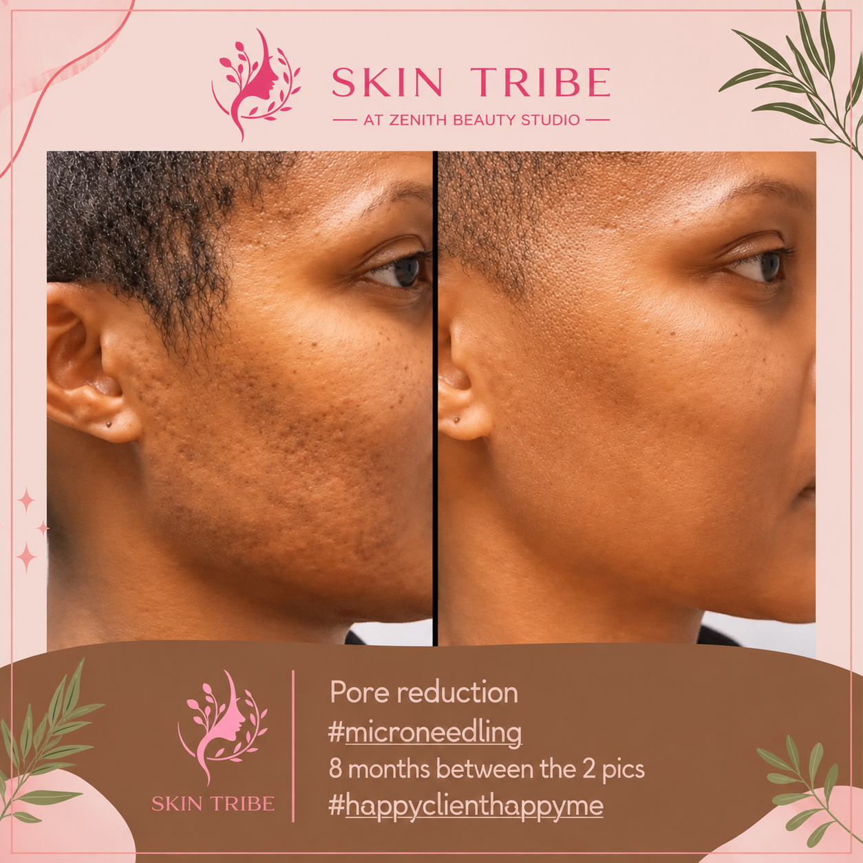 Skin Tribe, photo 6 of 6